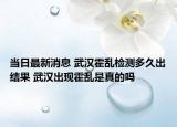 當(dāng)日最新消息 武漢霍亂檢測(cè)多久出結(jié)果 武漢出現(xiàn)霍亂是真的嗎