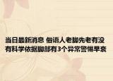 當日最新消息 俗語人老腳先老有沒有科學依據(jù)腳部有3個異常警惕早衰