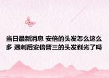 當(dāng)日最新消息 安倍的頭發(fā)怎么這么多 遇刺后安倍晉三的頭發(fā)剃光了嗎