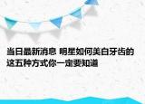 當(dāng)日最新消息 明星如何美白牙齒的 這五種方式你一定要知道