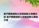 男子瞞著燒傷父親割皮救父詳細內(nèi)容 男子瞞著燒傷父親割皮救父具體介紹