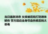 當(dāng)日最新消息 女孩被后媽打到遍體鱗傷 警方回應(yīng)全身帶血傷痕后媽太惡毒