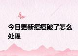 今日更新痘痘破了怎么處理