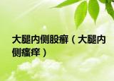 大腿內(nèi)側(cè)股癬（大腿內(nèi)側(cè)瘙癢）