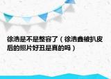 徐浩是不是整容了（徐浩鑫被扒皮后的照片好丑是真的嗎）