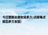今日更新去痣恢復(fù)多久(點(diǎn)痣筆點(diǎn)痣后多久恢復(fù))