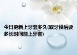 今日更新上牙套多久(取牙模后要多長時間能上牙套)