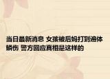 當(dāng)日最新消息 女孩被后媽打到遍體鱗傷 警方回應(yīng)真相是這樣的