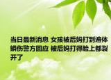 當日最新消息 女孩被后媽打到遍體鱗傷警方回應 被后媽打得臉上都裂開了