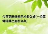 今日更新痔瘡手術多久好(一拉屎痔瘡就出血怎么辦)