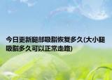 今日更新腿部吸脂恢復多久(大小腿吸脂多久可以正常走路)