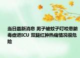 當日最新消息 男子被蚊子叮咬患膿毒癥進ICU 雙腿紅腫熱痛情況很危險