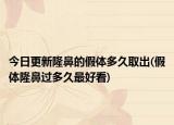 今日更新隆鼻的假體多久取出(假體隆鼻過多久最好看)