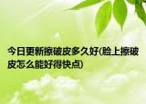 今日更新擦破皮多久好(臉上擦破皮怎么能好得快點)