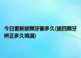 今日更新拔顆牙要多久(拔四顆牙矯正多久填滿)