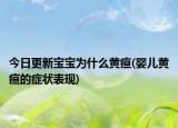 今日更新寶寶為什么黃疸(嬰兒黃疸的癥狀表現(xiàn))