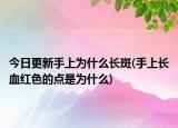 今日更新手上為什么長斑(手上長血紅色的點是為什么)