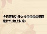 今日更新為什么長(zhǎng)痘痘痘痘里面是什么(臉上長(zhǎng)痘)