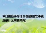 今日更新手為什么老是脫皮(手脫皮是什么病的預(yù)兆)