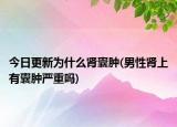 今日更新為什么腎囊腫(男性腎上有囊腫嚴(yán)重嗎)