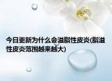 今日更新為什么會溢脂性皮炎(脂溢性皮炎范圍越來越大)