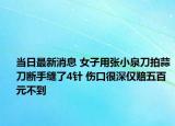 當(dāng)日最新消息 女子用張小泉刀拍蒜刀斷手縫了4針 傷口很深僅賠五百元不到