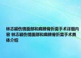 林志穎傷情面部和肩膀骨折需手術(shù)詳細內(nèi)容 林志穎傷情面部和肩膀骨折需手術(shù)具體介紹