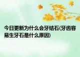 今日更新為什么會(huì)牙結(jié)石(牙齒容易生牙石是什么原因)