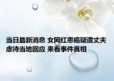 當(dāng)日最新消息 女網(wǎng)紅患癌疑遭丈夫虐待當(dāng)?shù)鼗貞?yīng) 來看事件真相