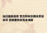 當(dāng)日最新消息 警方稱林志穎未系安全帶 目前重傷未完全清醒