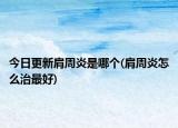 今日更新肩周炎是哪個(gè)(肩周炎怎么治最好)