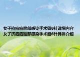 女子擠痘痘臉部感染手術(shù)縫6針詳細(xì)內(nèi)容 女子擠痘痘臉部感染手術(shù)縫6針具體介紹