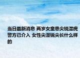 當(dāng)日最新消息 兩歲女童患尖銳濕疣警方已介入 女性尖濕銳尖長(zhǎng)什么樣的