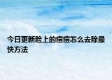 今日更新臉上的痘痘怎么去除最快方法