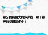 鑲牙的費(fèi)用大約多少錢一顆（鑲牙的費(fèi)用是多少）
