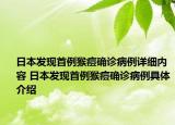 日本發(fā)現(xiàn)首例猴痘確診病例詳細(xì)內(nèi)容 日本發(fā)現(xiàn)首例猴痘確診病例具體介紹