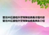 曾光80后要格外警惕猴痘病毒詳細(xì)內(nèi)容 曾光80后要格外警惕猴痘病毒具體介紹