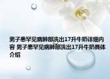 男子患罕見(jiàn)病肺部洗出17升牛奶詳細(xì)內(nèi)容 男子患罕見(jiàn)病肺部洗出17升牛奶具體介紹