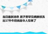當(dāng)日最新消息 男子患罕見(jiàn)病肺部洗出17升牛奶畫(huà)面令人驚呆了