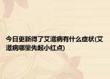 今日更新得了艾滋病有什么癥狀(艾滋病哪里先起小紅點(diǎn))