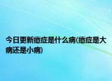 今日更新癔癥是什么病(癔癥是大病還是小病)
