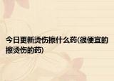 今日更新?tīng)C傷擦什么藥(很便宜的擦燙傷的藥)