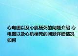 心電圖以及心肌梗死的問題介紹 心電圖以及心肌梗死的問題詳細情況如何
