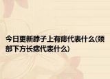 今日更新脖子上有痣代表什么(頸部下方長(zhǎng)痣代表什么)