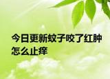 今日更新蚊子咬了紅腫怎么止癢