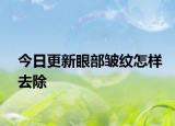今日更新眼部皺紋怎樣去除