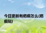 今日更新有疤痕怎么(疤痕貼)