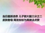 當日最新消息 兒子割大腿三分之二皮膚救母 網(wǎng)友紛紛為其做法點贊