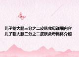 兒子割大腿三分之二皮膚救母詳細內(nèi)容 兒子割大腿三分之二皮膚救母具體介紹