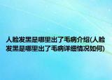 人臉發(fā)黑是哪里出了毛病介紹(人臉發(fā)黑是哪里出了毛病詳細(xì)情況如何)